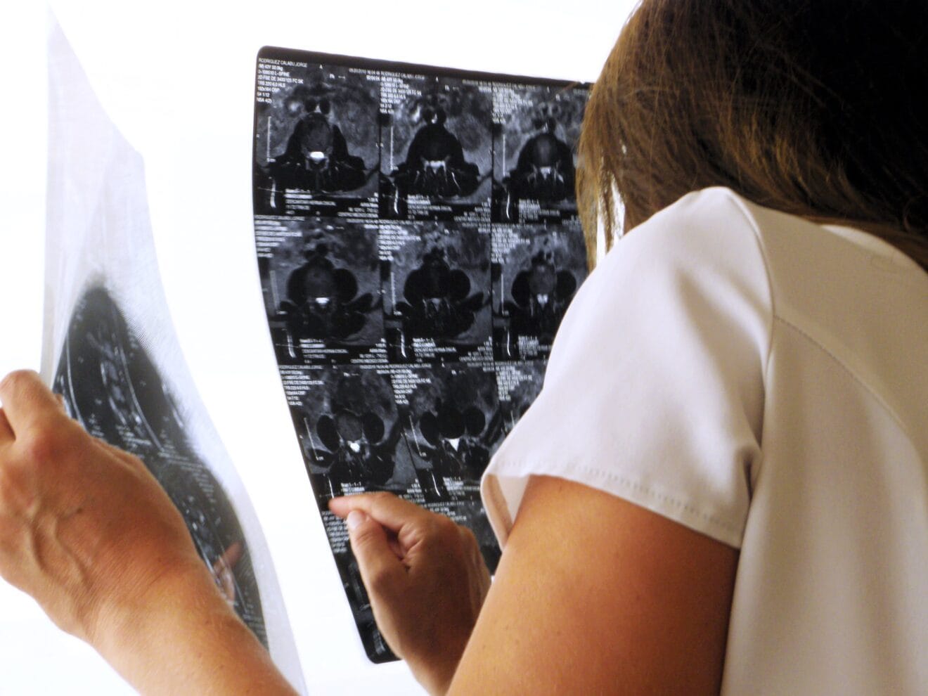 Gata Quiropráctica, análisis de radiografías