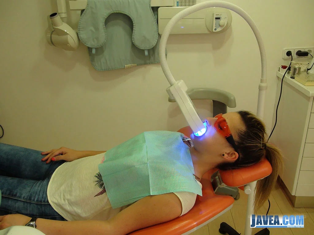 Clínica Dental Puchol, blanqueamientos dentales