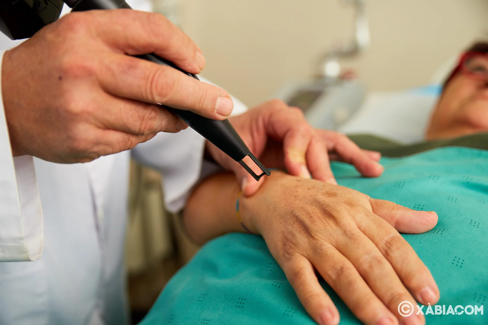 Quitar manchas de las manos Jávea – Policlínica Cume