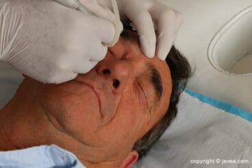 Tratamientos Médicos en Jávea – Policlínica Cume