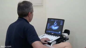 Ecocardiografía REMA