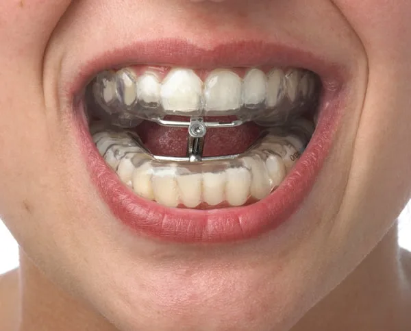 orthoapnea06
