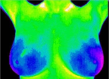 La salud y cuidado del pecho