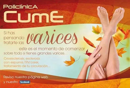 Tratamiento de Varices PoliclÍnica CUME