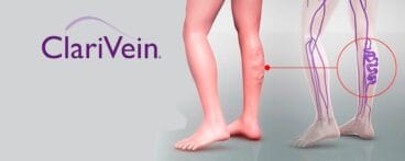 Clariven Clínica Estética Castelblanque