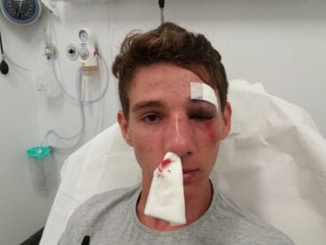 Alex estuvo hospitalizado por las lesiones sufridas