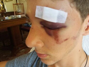 Alex sufre varias lesiones a causa de los golpes