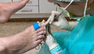 Consulta de podología en Jávea con atención integral