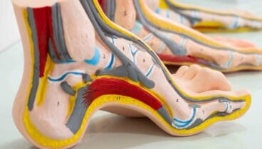 Diagnóstico y tratamiento de micosis en los pies