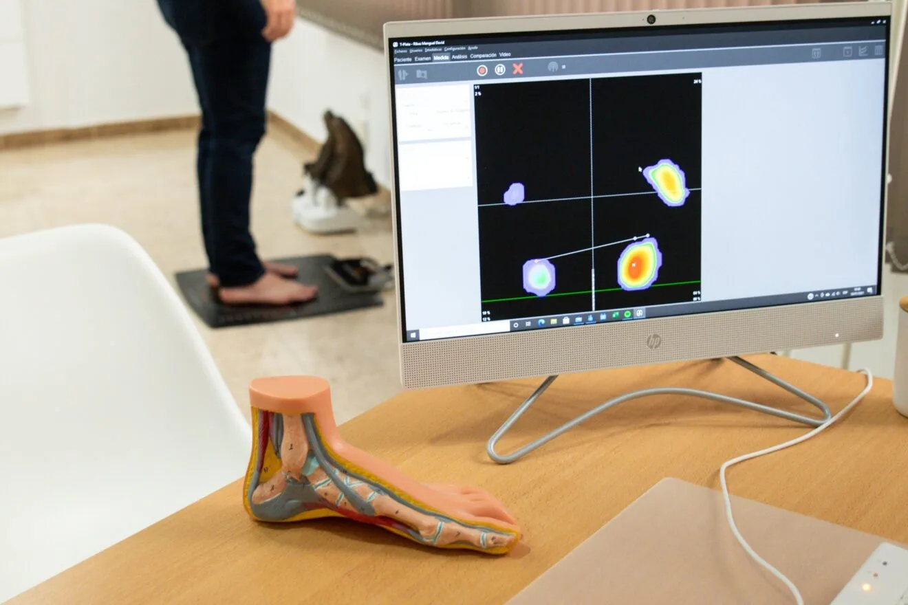 Estudio biomecánico Jávea - Podología Ana Belén Ivars Buigues