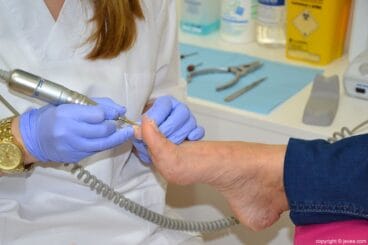 Limado Podología Ana Belén Ivars Buigues