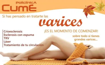 Varices Policlínica CUME