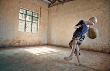 La exposición Albino de Ana Palacios se completará con una conferencia en el hospital