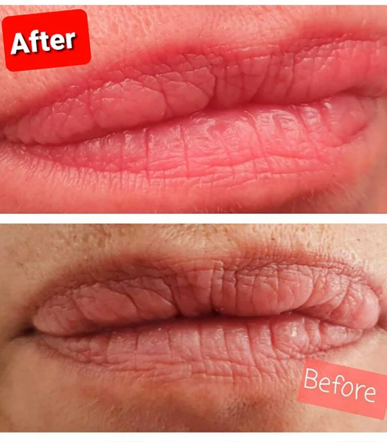 Aquarell lips - Centro de Estetica ONIX