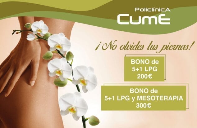 Imagen: Bonos para el tratamiento de las piernas en Policlínica CUME