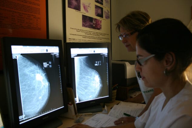 Imagen: Cáncer de mama