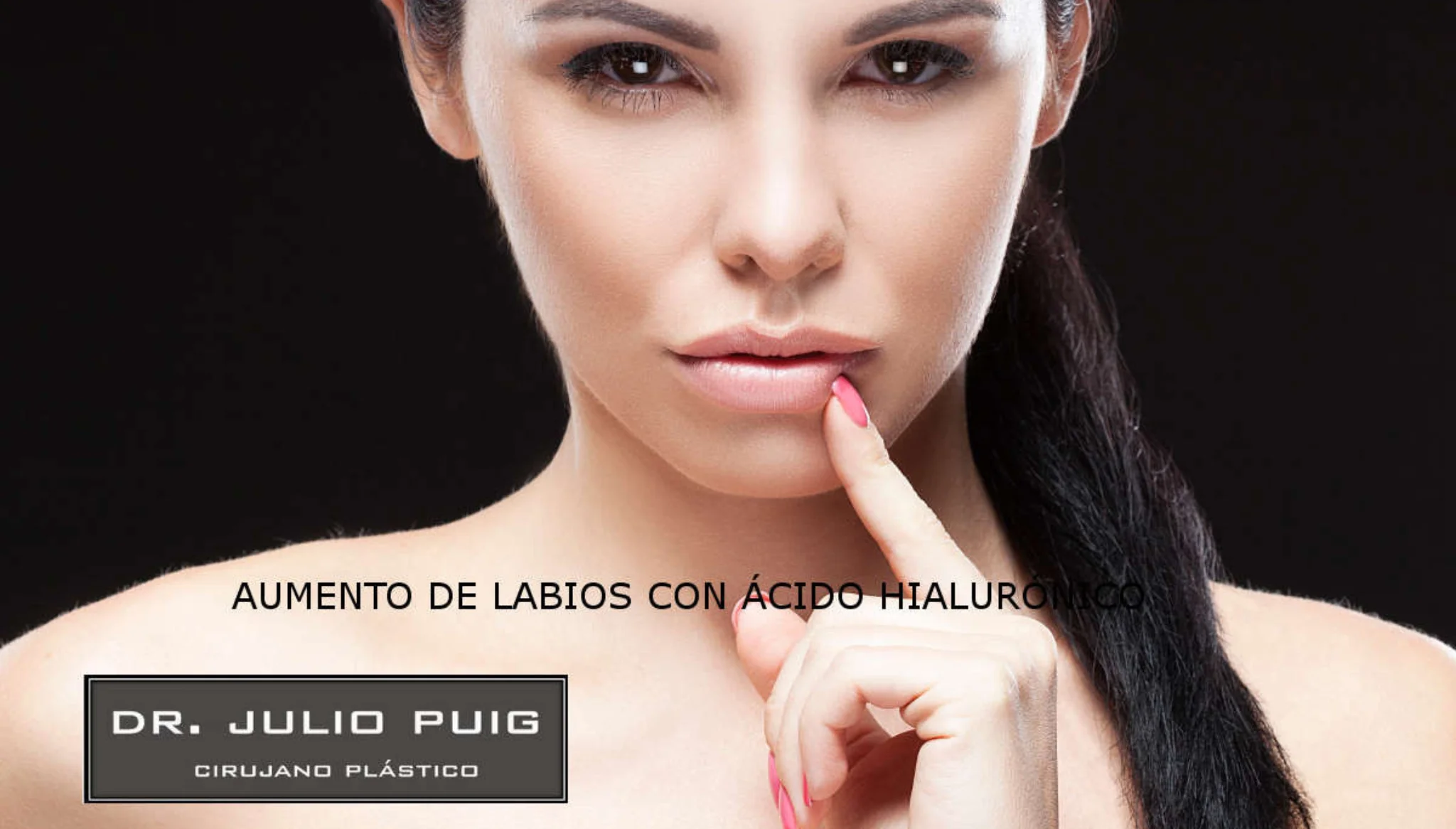 Aumento de labios con ácido hialurónico – Dr Julio Puig