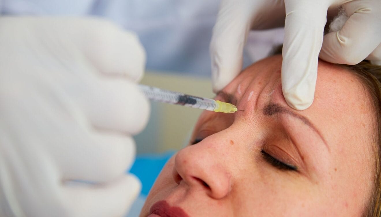 Piel rejuvenecida con el tratamiento de bótox de Policlínica CUME