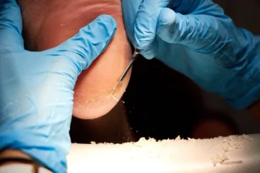 podologo-denia-clinica-podologica-estevez 10.13.50.jpg