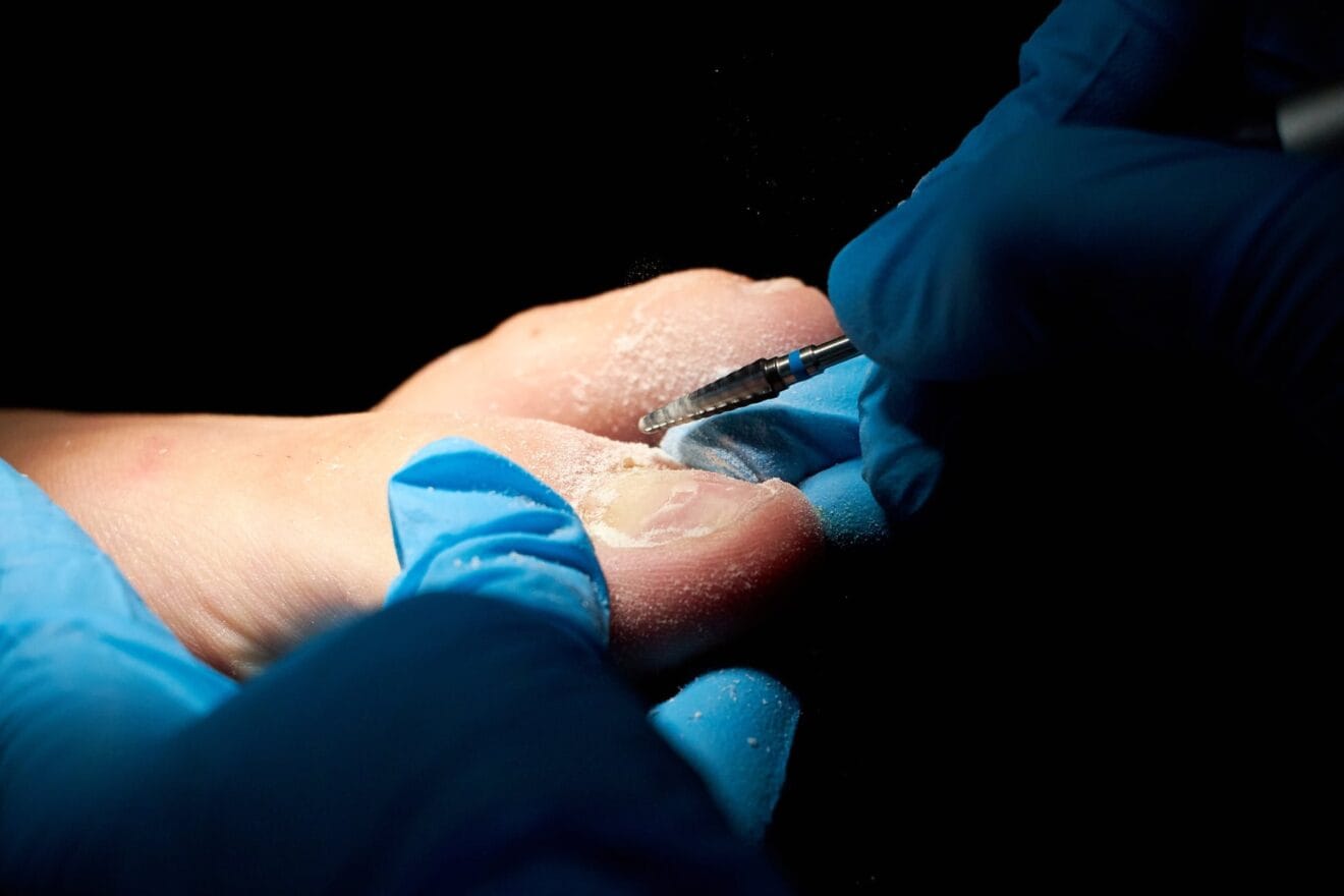 Podologos en Denia – Clinica Podologica Estevez
