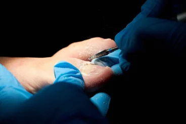 podologos-en-denia-clinica-podologica-estevez.jpg