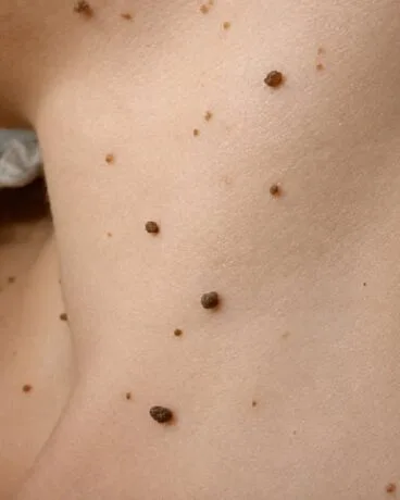 Procedimientos quirúrgicos de estética facial y corporal