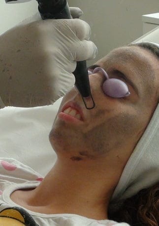 Imagen: Descubre los tratamientos láser de Policlínica CUME