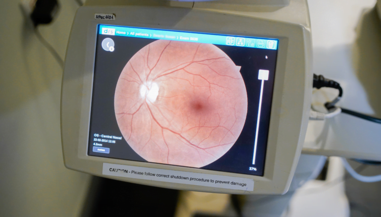 Imágenes del fondo ocular en Specsavers Ópticas