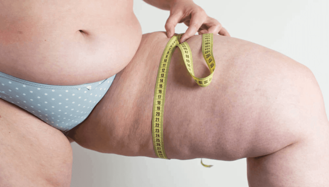Lifting de muslos en Clínicas de cirugía estética Dr. Julio Puig