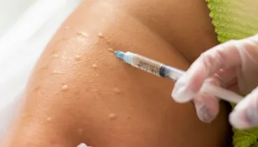 Conoce las ventajas de la Mesoterapia para lucir una piel radiante antes del verano