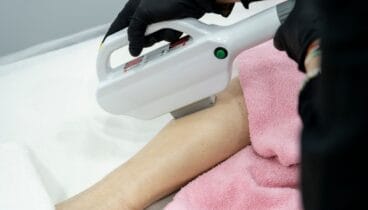 Sesión de fotodepilación médica con packs personalizados en la Marina Alta