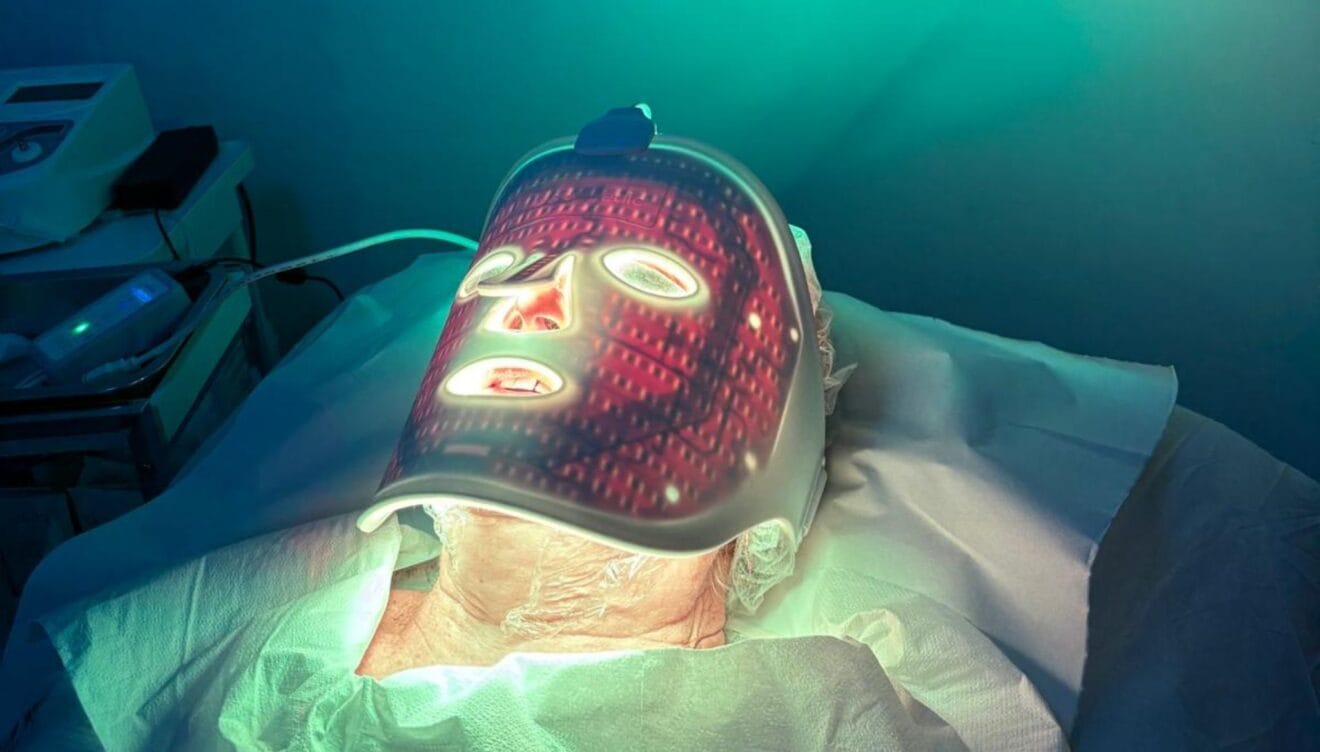 Tratamiento de fotobiodinámica para la regeneración celular del rostro en Denia