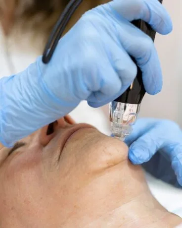 Exosomas, un protocolo ideal tanto para el rostro y el cuello como para la regeneración capilar