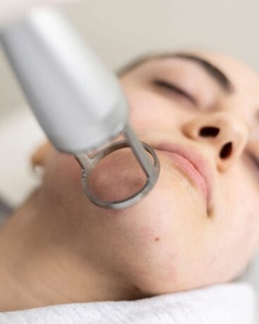 Procedimiento dermatológico profesional para cerrar los poros