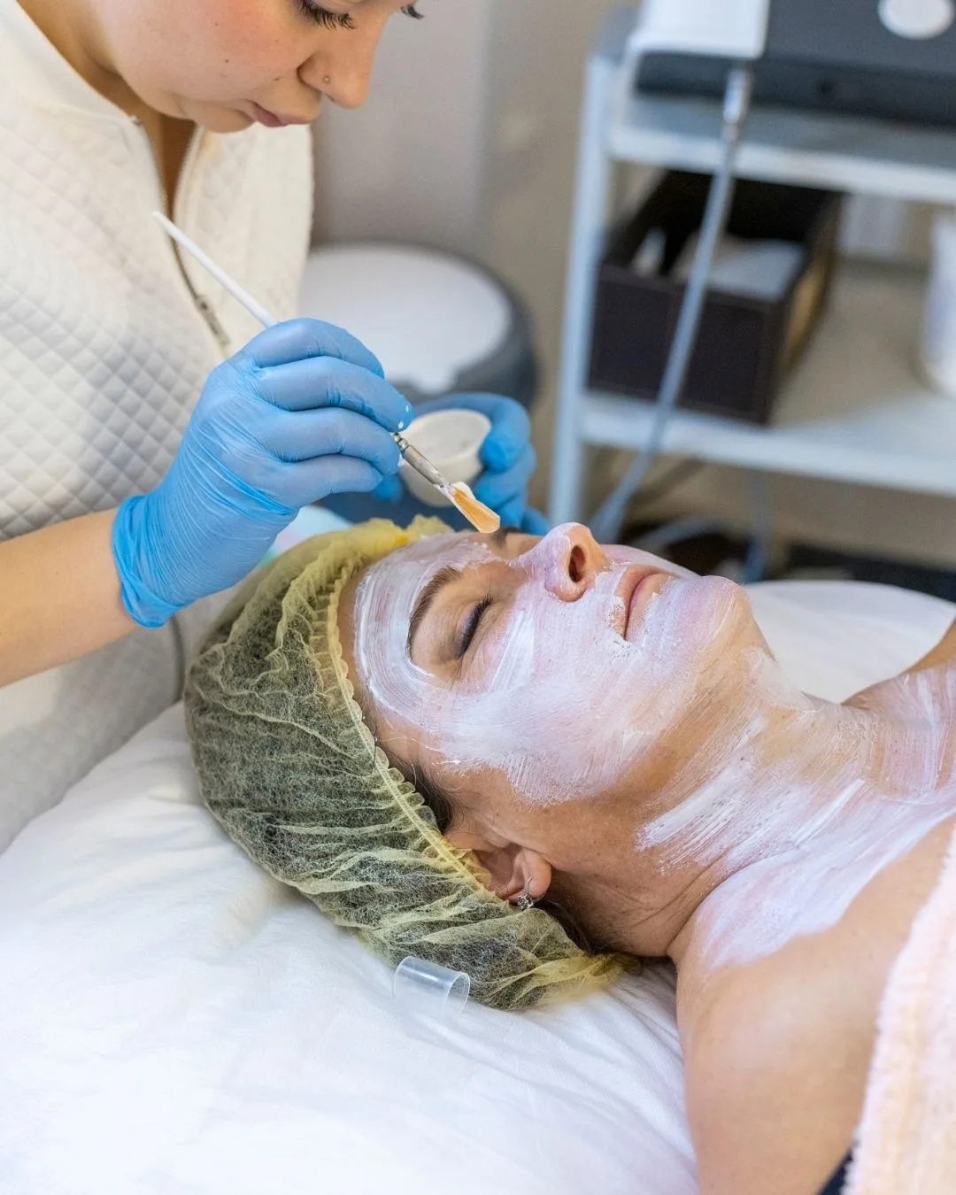 Tratamiento de medicina regenerativa con exosomas en el rostro