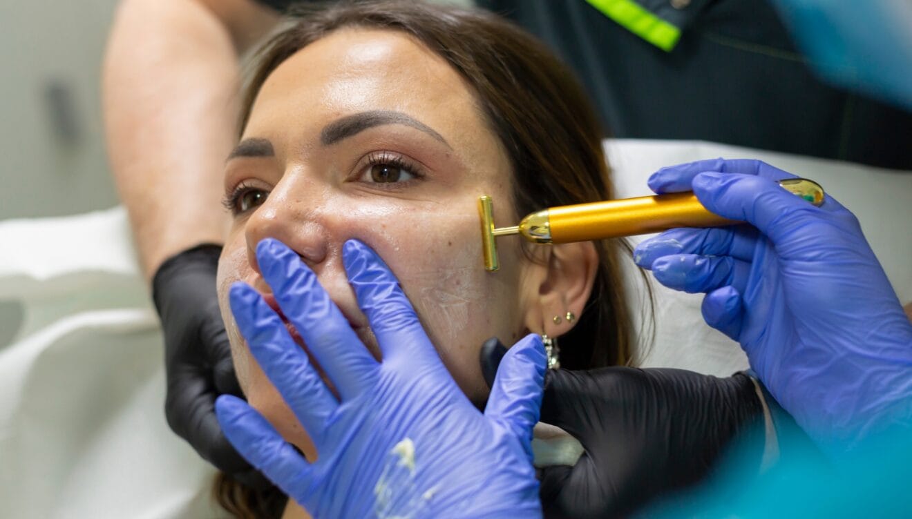 Técnicas de microneedling y mesoterapia