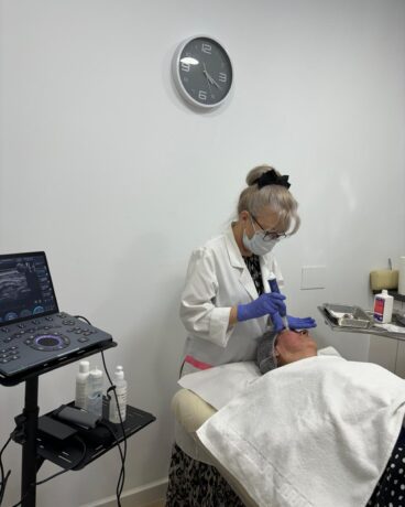 Tratamiento con Skinpen y Exosomas